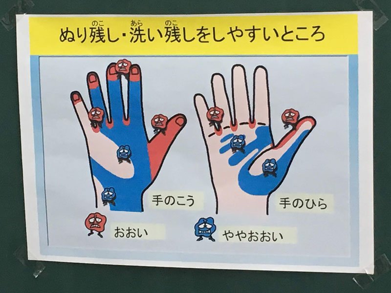 汚れやすいところ